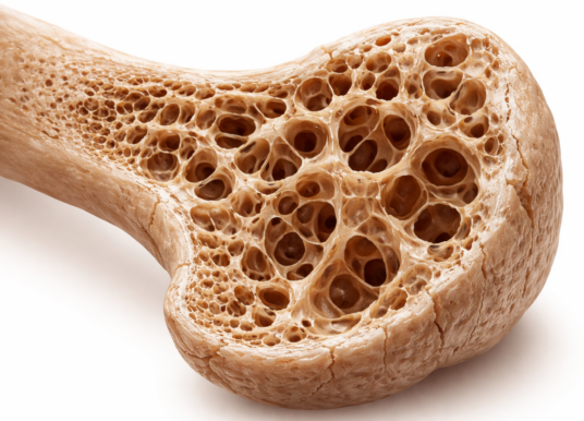 Opole bada kości. Rusza kolejna edycja bezpłatnej profilaktyki osteoporozy